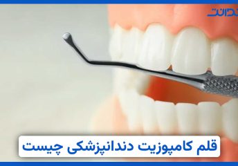 قلم کامپوزیت دندانپزشکی چیست؟