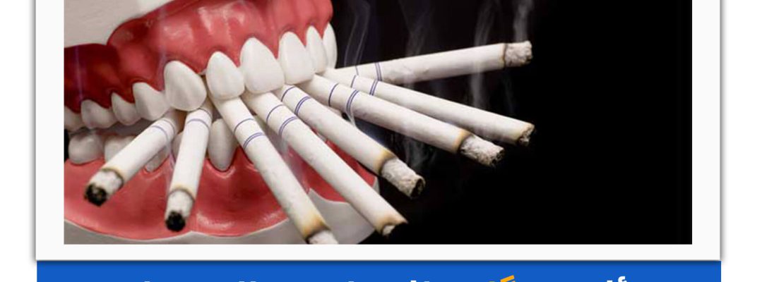 عکس از ماکت دندان که چندین سیگار را گرفته در دهان گرفته است.