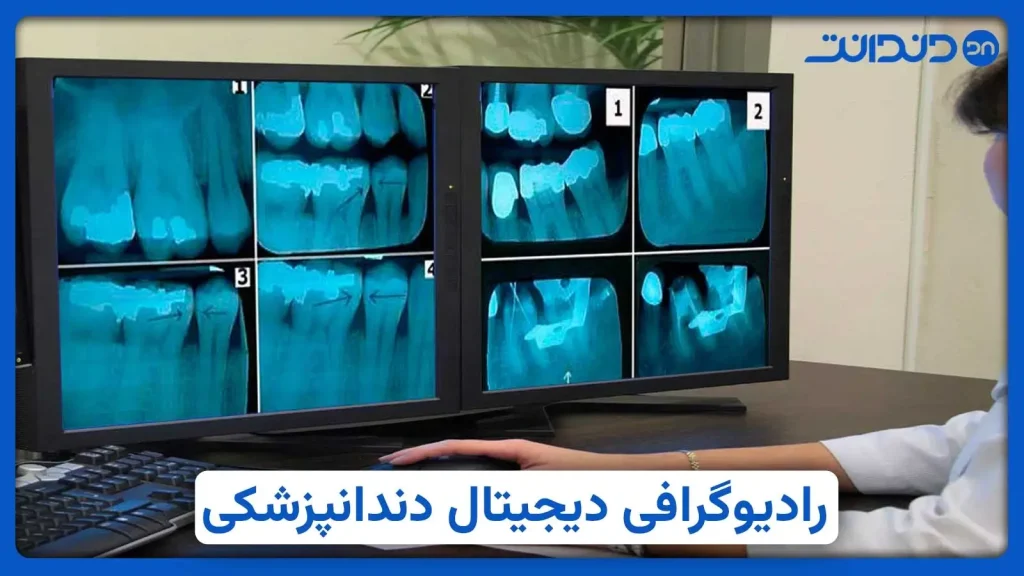 عکس از رادیوگرافی دیجیتال در دندانپزشکی