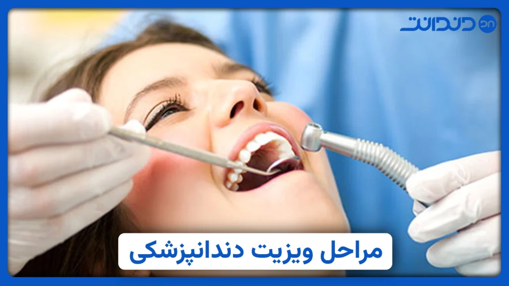 عکس از بیمار در حال ویزیت و معاینه دهان