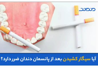 عکس ماکت دندان در کنار چند سیگار