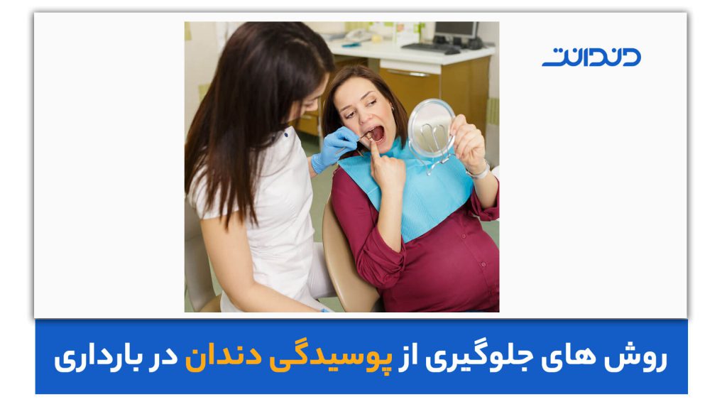 عکس خانم بارداری در دندانپزشکی که دندان خود را در آینه می بیند.