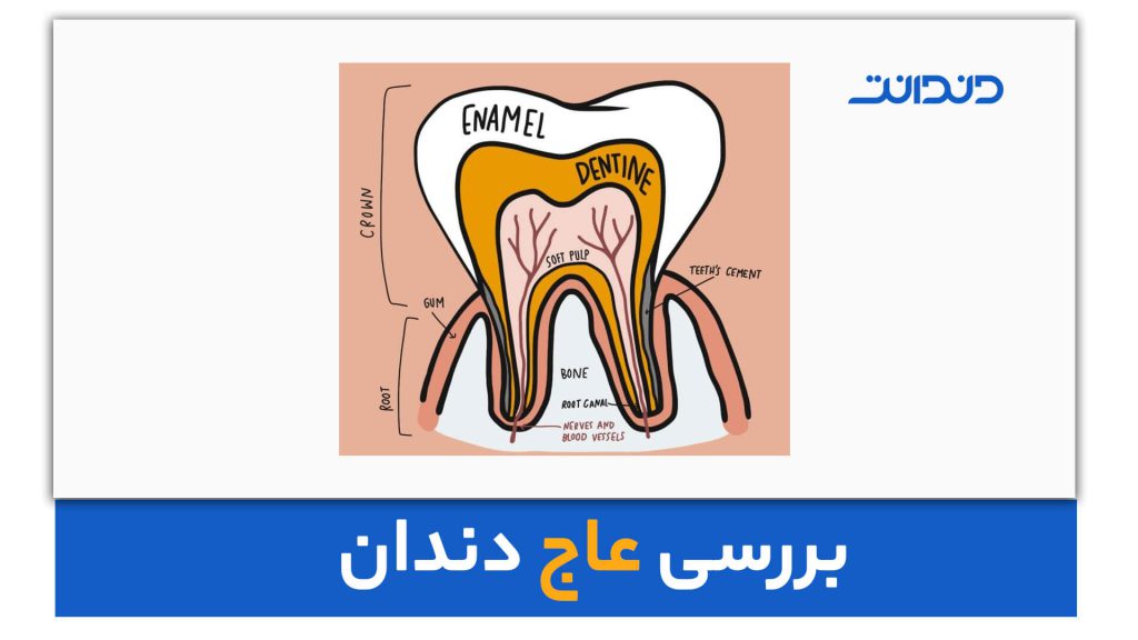 عکس از بررسی بخش های مختلف دندان و عاج دندان