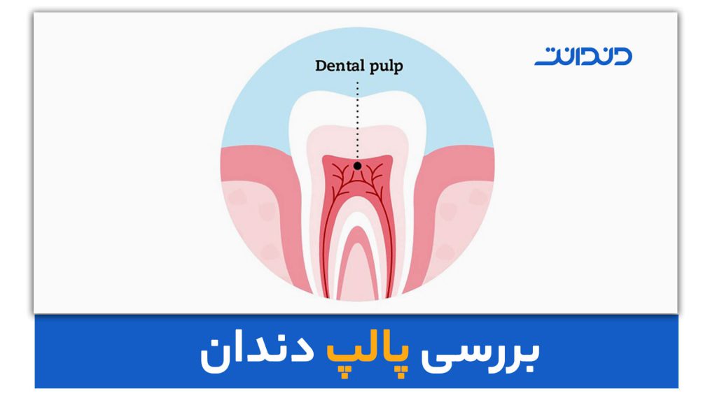 عکس از نشان دادن موقعیت پالپ دندان