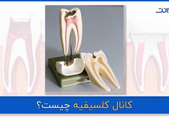 عکس نزدیک از دندان