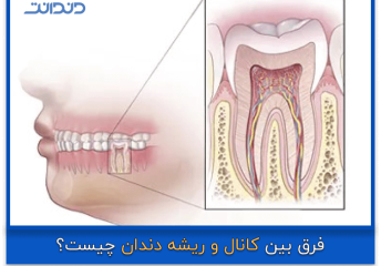 عکس نزدیک از آناتومی دندان برای بررسی تفاوت کانال و ریشه دندان