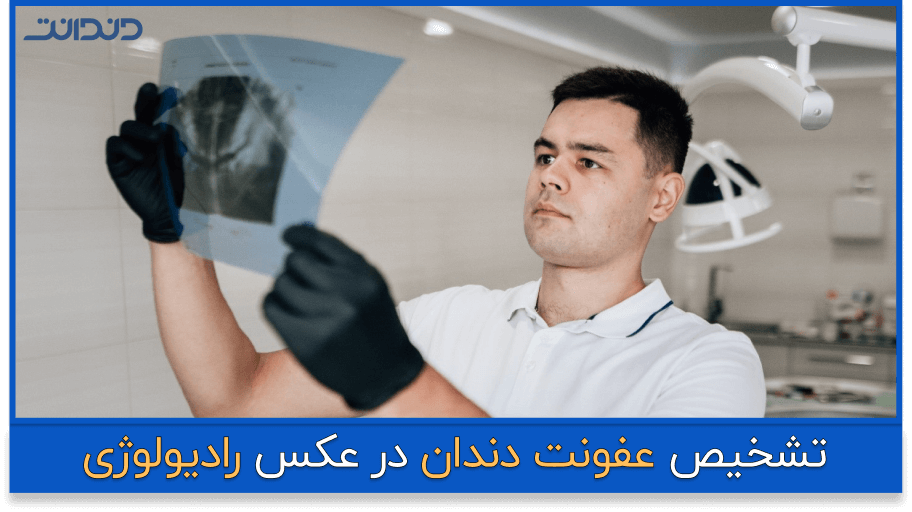 تشخیص عفونت دندان در عکس رادیولوژی