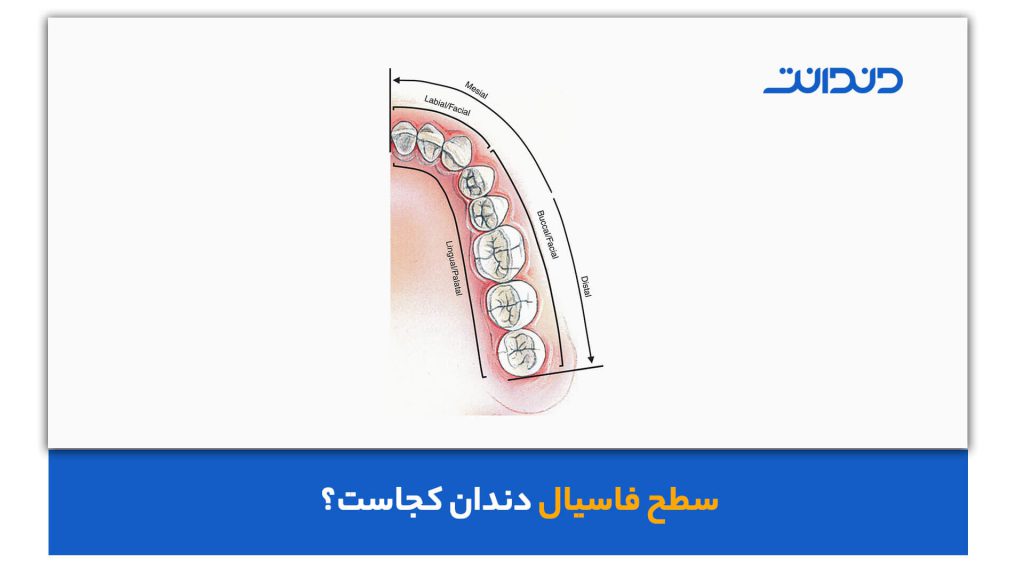 عکس از سطح فاسیال دندان