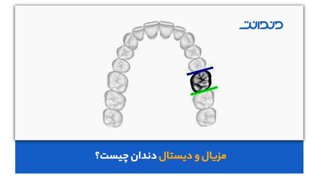 مزیال و دیستال دندان 