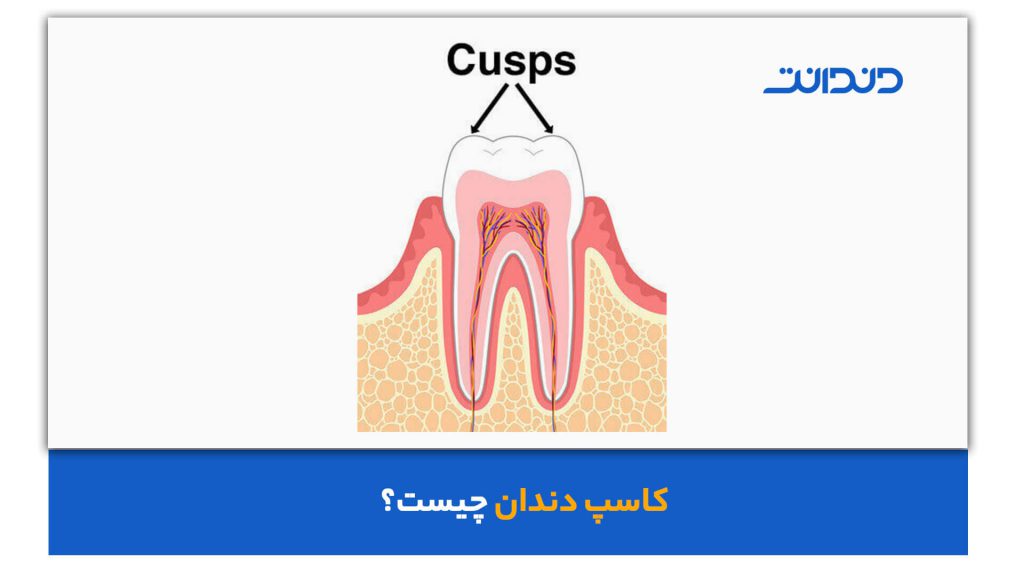 عکس از کاسپ دندان