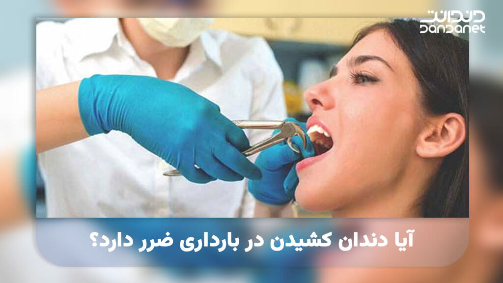 آیا کشیدن دندان در بارداری ضرر دارد؟
