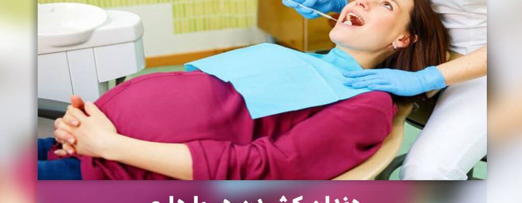 کشیدن دندان در بارداری