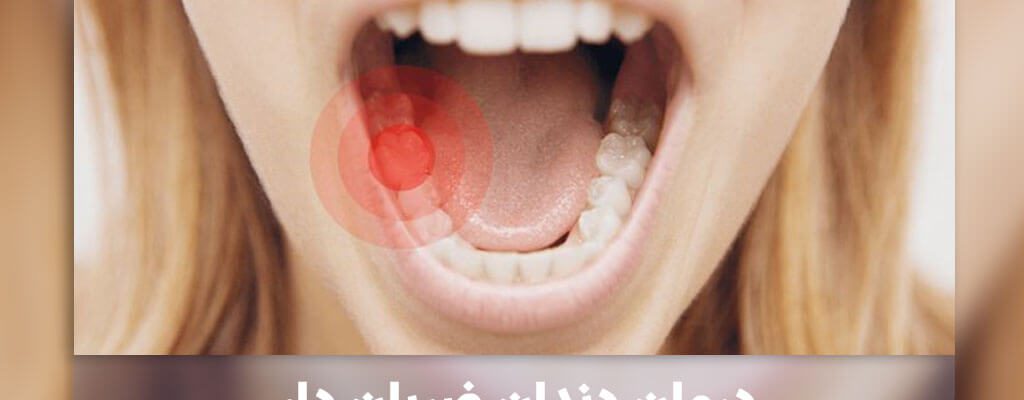 درمان دندان ضربان دار