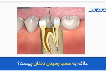 علائم به عصب رسیدن دندان چیست