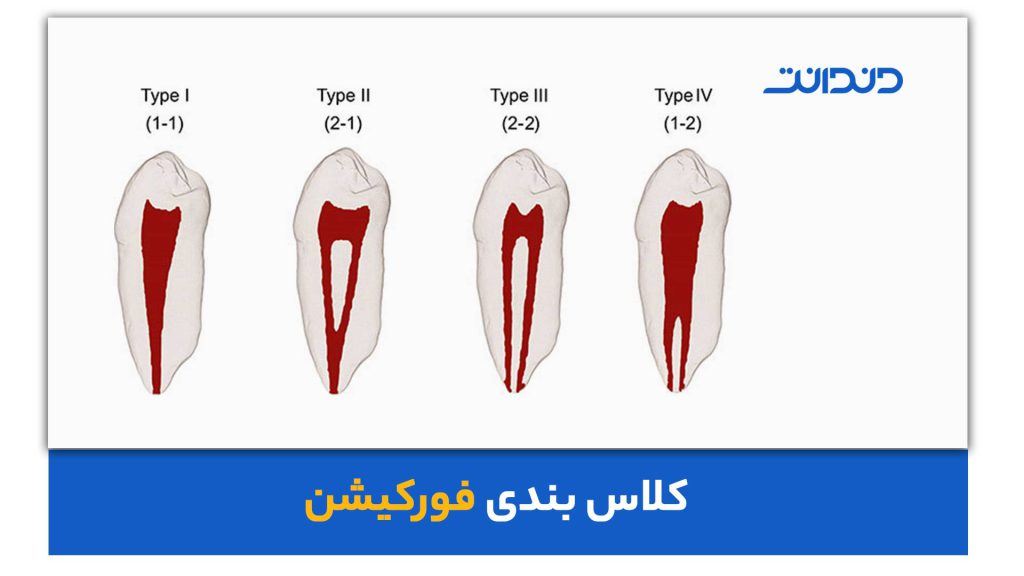 کلاس بندی فورکیشن